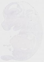 EMAGE:20218