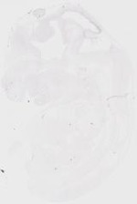 EMAGE:20218