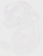 EMAGE:20218