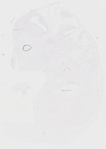 EMAGE:20218