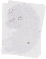 EMAGE:20218