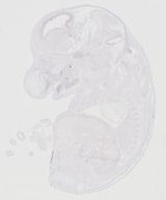 EMAGE:20272