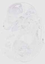 EMAGE:20318