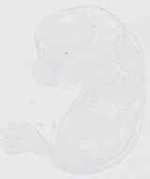 EMAGE:20352