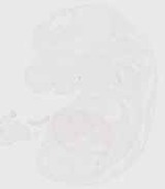 EMAGE:20358