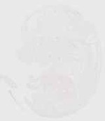 EMAGE:20358