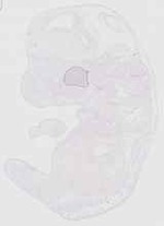 EMAGE:20379
