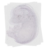 EMAGE:20395