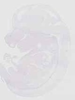 EMAGE:20405