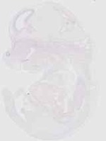 EMAGE:20437