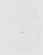 EMAGE:20438