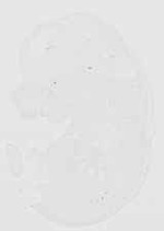 EMAGE:20438