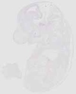 EMAGE:20454