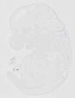 EMAGE:20515