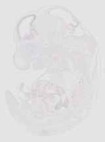 EMAGE:20527