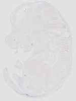 EMAGE:20587