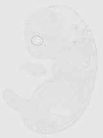 EMAGE:20615