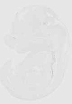 EMAGE:20615