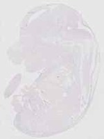 EMAGE:20615