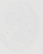 EMAGE:20626