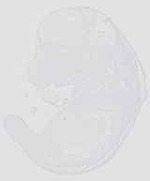 EMAGE:20629