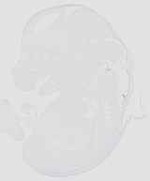 EMAGE:20629