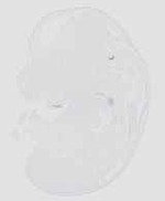 EMAGE:20629