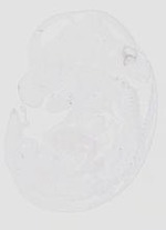 EMAGE:20630