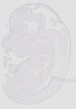 EMAGE:20631