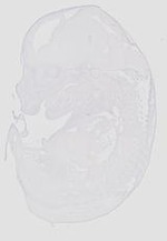 EMAGE:20631