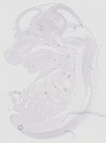 EMAGE:20637
