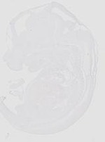 EMAGE:20643