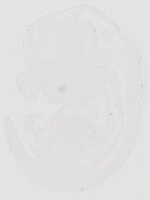 EMAGE:20644