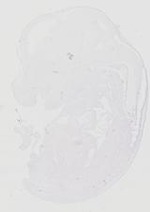 EMAGE:20644