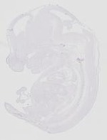 EMAGE:20652