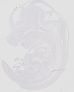 EMAGE:20652