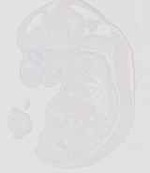 EMAGE:20662