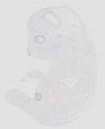 EMAGE:20751