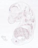 EMAGE:21007