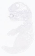 EMAGE:21017