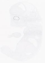 EMAGE:21017