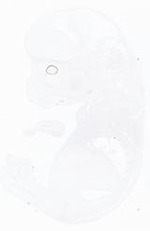 EMAGE:21017