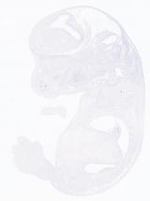 EMAGE:21017