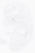 EMAGE:21017
