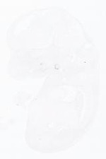EMAGE:21017