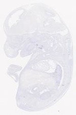 EMAGE:21017