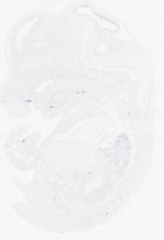 EMAGE:21017