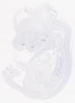 EMAGE:21017