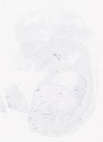 EMAGE:21017