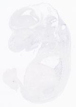 EMAGE:21017